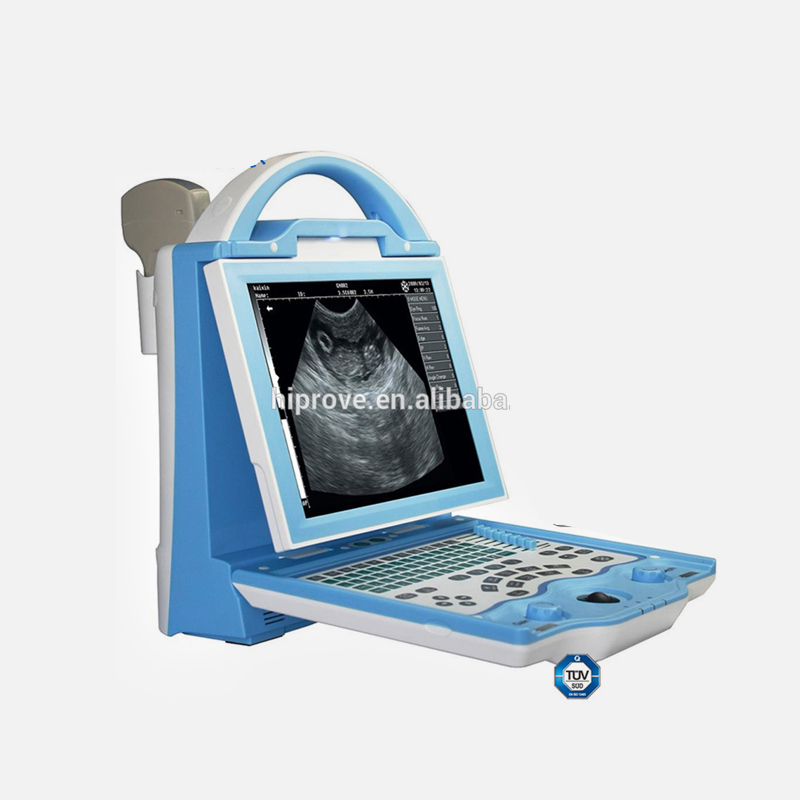 Digital Portable Ultrasound Scanner